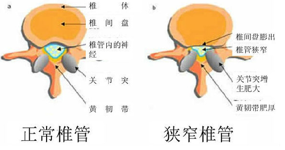 26-151216135F23N 26-151216135F23N