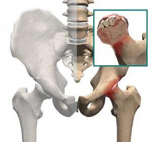 wan55dfe28fa55a61.25432869 wan55dfe28fa55a61.25432869