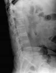 下载 (1) 下载 (1)