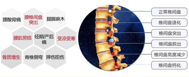 1509954684731755.jpg 腰椎4.jpg