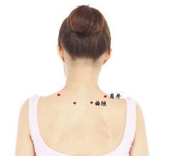 中医中肩周炎分五型 中医中肩周炎分五型