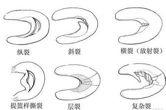 u=982702967,1359365666&fm=21&gp=0 u=982702967,1359365666&fm=21&gp=0