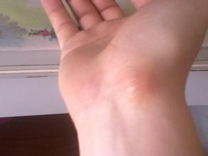 u=3495533530,2766468518&fm=21&gp=0 u=3495533530,2766468518&fm=21&gp=0