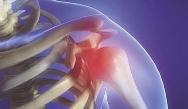 肩周炎更青睐中老年人 肩周炎更青睐中老年人