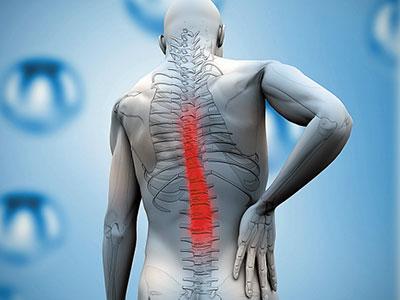 1511943173844455.jpg 腰椎间盘膨出.jpg