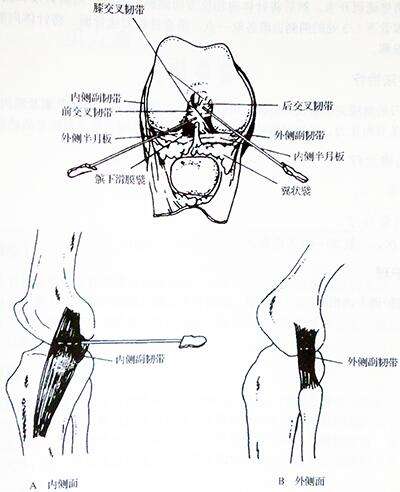 小针刀治疗膝关节炎图解 小针刀治疗膝关节炎图解