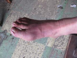 1512030130719534.jpg 痛风.jpg