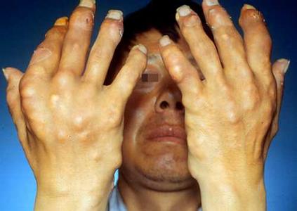 u=3768861,3546870845&fm=11&gp=0 u=3768861,3546870845&fm=11&gp=0