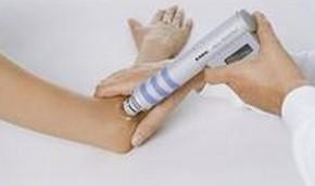 网球肘用什么方法可以医治 网球肘用什么方法可以医治