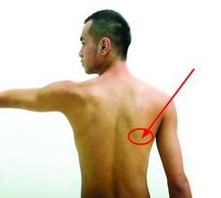 1512290536203970.jpg 肩周炎.jpg