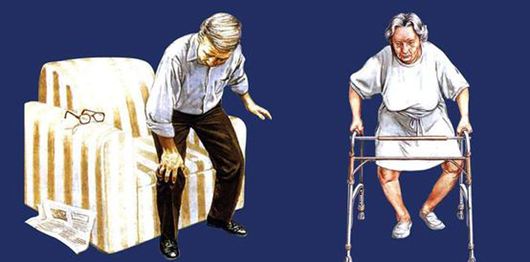 1516519136375968.jpg 骨性关节炎5.jpg