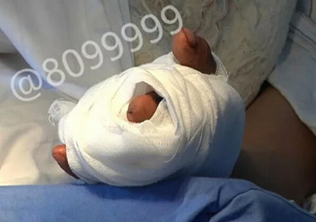 1520579508757359.jpg 骡子受惊 伤主人手指.jpg