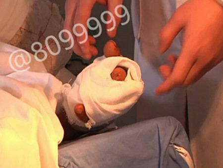 1520581373162574.jpg 伤者.jpg