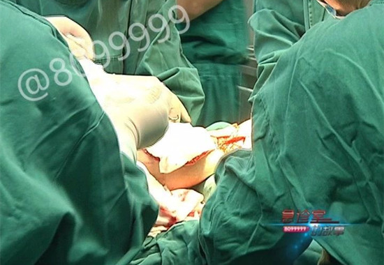 1531186899266108.jpg 皮瓣修复.jpg