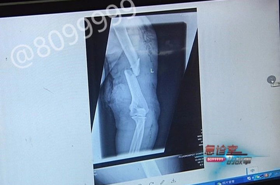 1535357705113367.jpg 片子.jpg