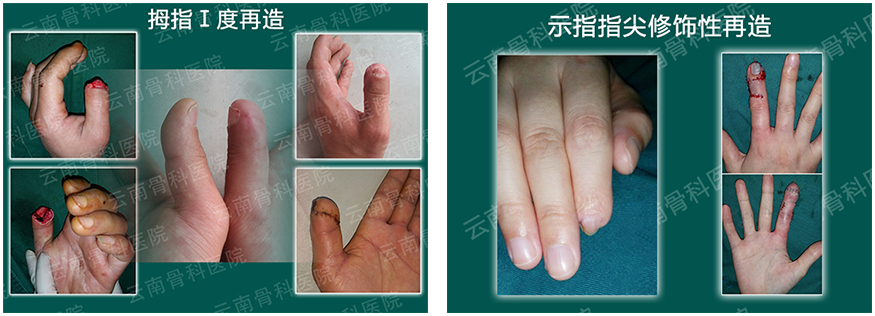 1536112956118389.png 拼接一.png