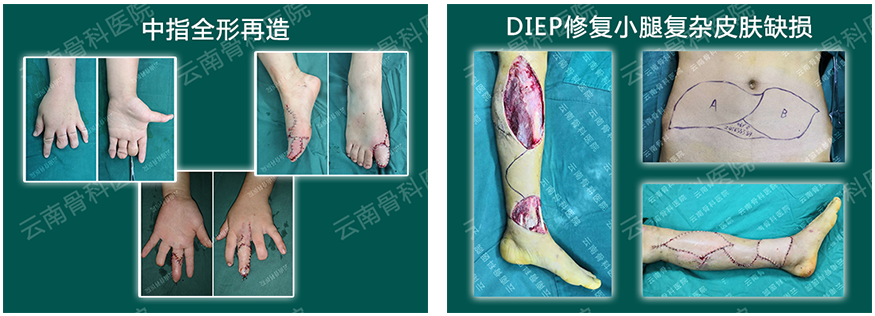 1536112985134603.png 拼接三.png