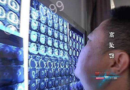 1537165249880344.jpg 医生看片子_副本.jpg