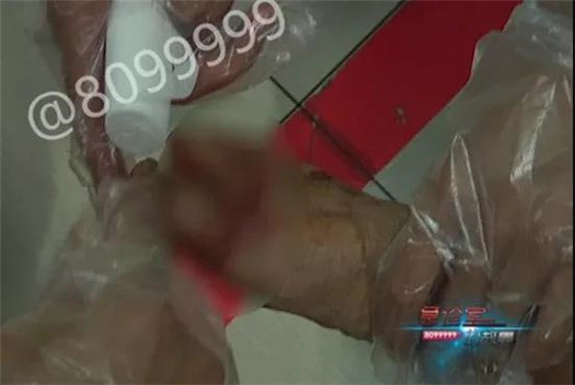 1538122839348944.jpg 脚趾.jpg