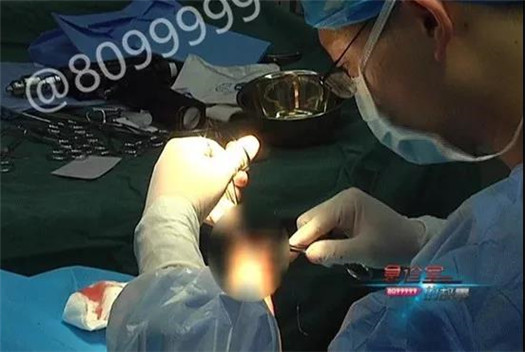 1538122907926043.jpg 手术.jpg