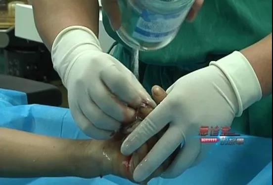 1540784153389222.jpg 清洗血污.jpg