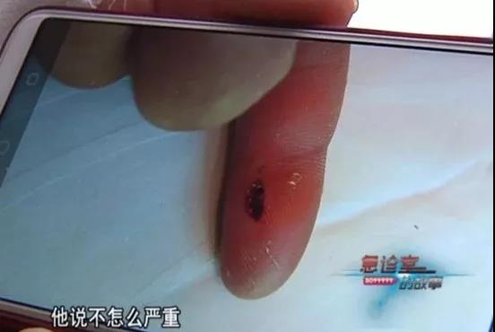 1540784331784641.jpg 看似不严重的伤口.jpg