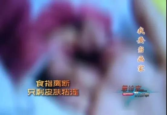 1545439437116345.jpg 食指.jpg