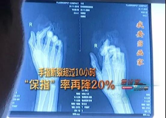 1545439542273983.jpg 保指.jpg